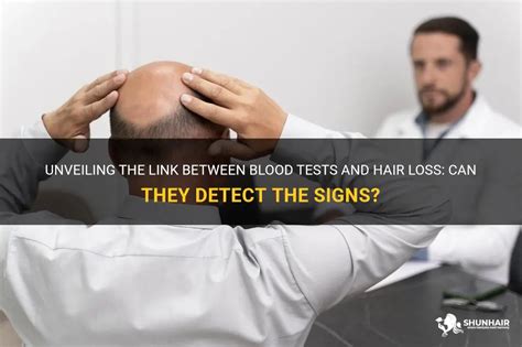 Can a blood test detect hair loss?