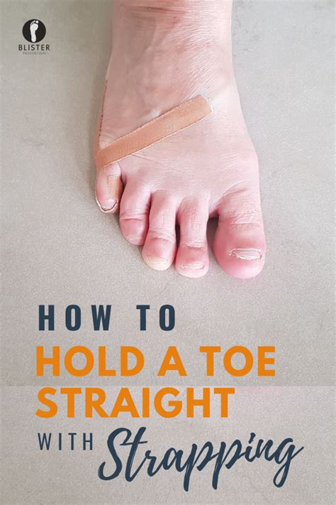 Can a curved toe be straightened?