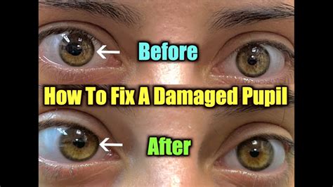Can a damaged eye repair itself?