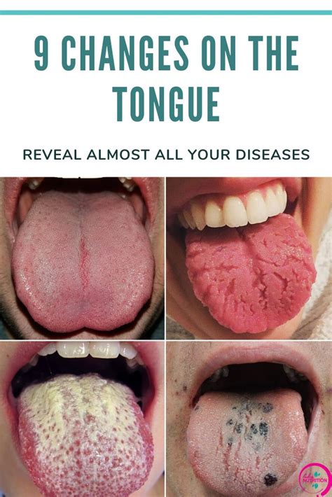 Can a damaged tongue heal?