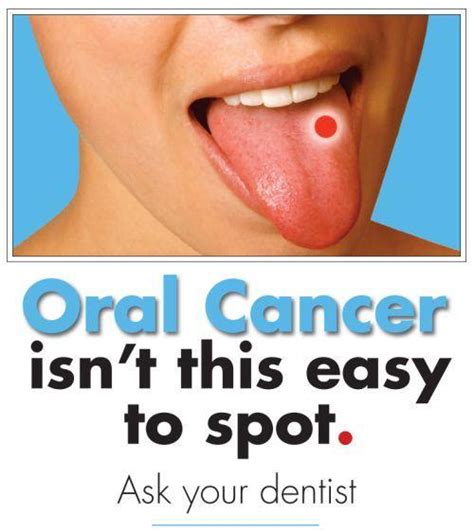 Can a dentist suspect cancer?