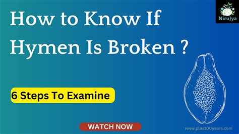 Can a doctor tell if a hymen is broken?