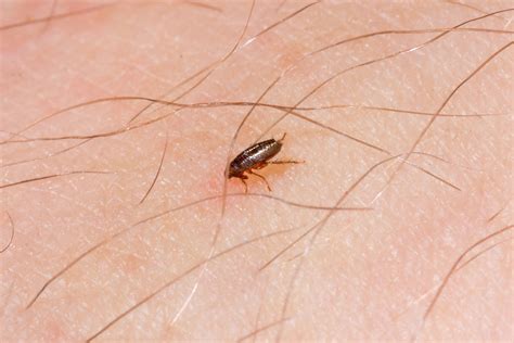 Can a flea lay eggs on a human?