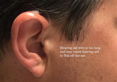 Can a hearing aid get stuck in your ear?
