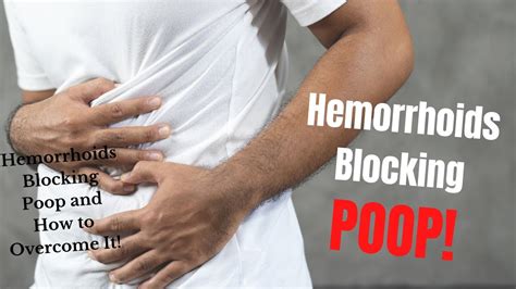 Can a hemorrhoid block poop?