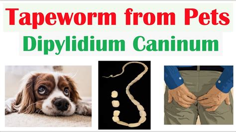 Can a human get tapeworms from a dog?
