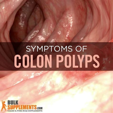 Can a large polyp cause symptoms?