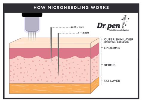 Can a needle penetrate a bone?