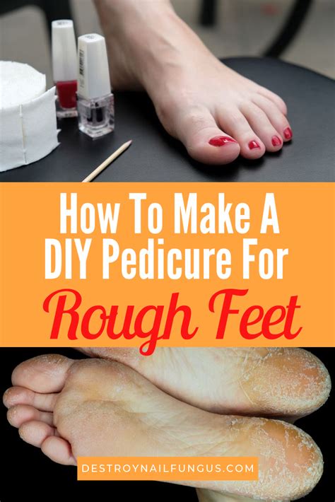 Can a pedicure fix rough feet?