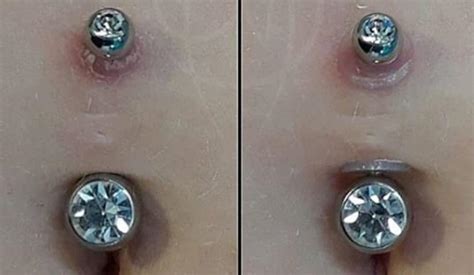 Can a piercing hole move?