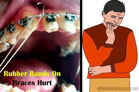 Can a rubber band hurt you?