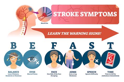 Can a stroke start with ear pain?