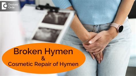 Can a woman break her hymen twice?