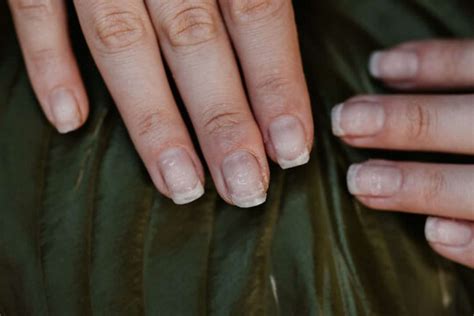 Can acrylic nails cause infertility?