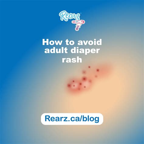 Can adults get diaper rash from pads?