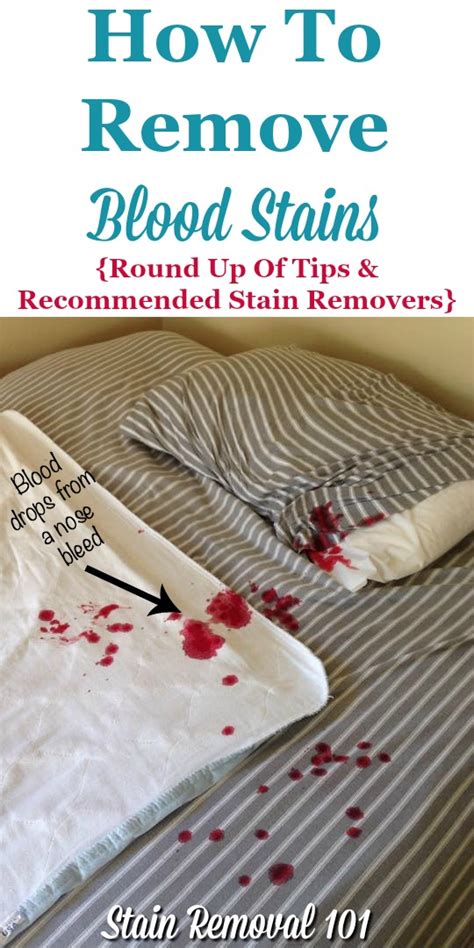 Can alcohol remove blood stains?