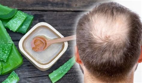 Can aloe vera cause hair loss?