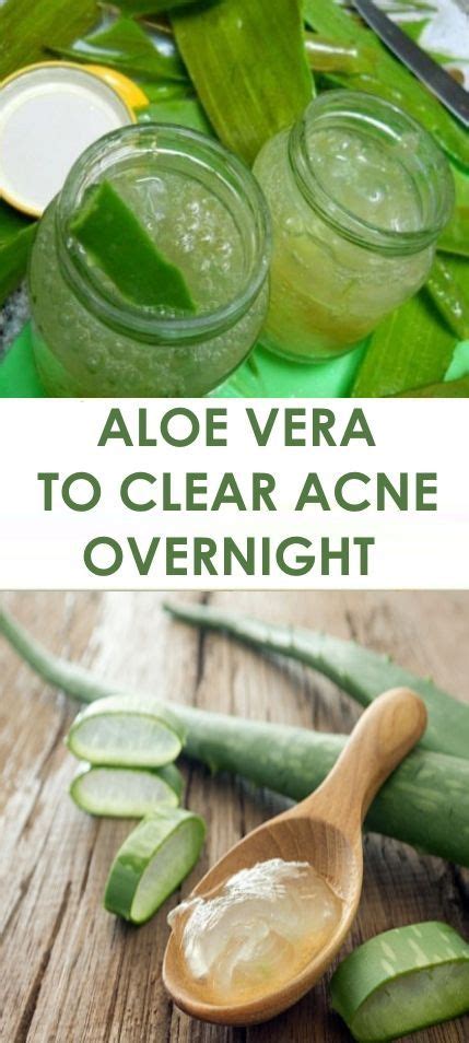 Can aloe vera clear skin overnight?