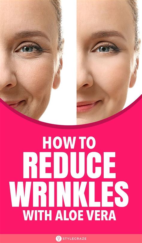 Can aloe vera gel help with wrinkles?