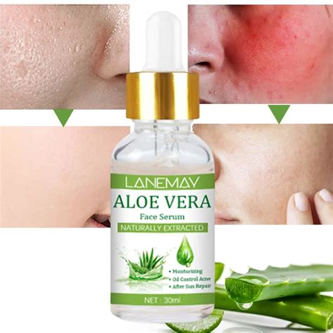 Can aloe vera shrink pores?