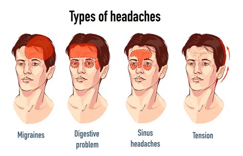 Can altitude cause tension headaches?