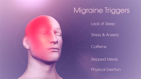 Can altitude trigger a migraine?