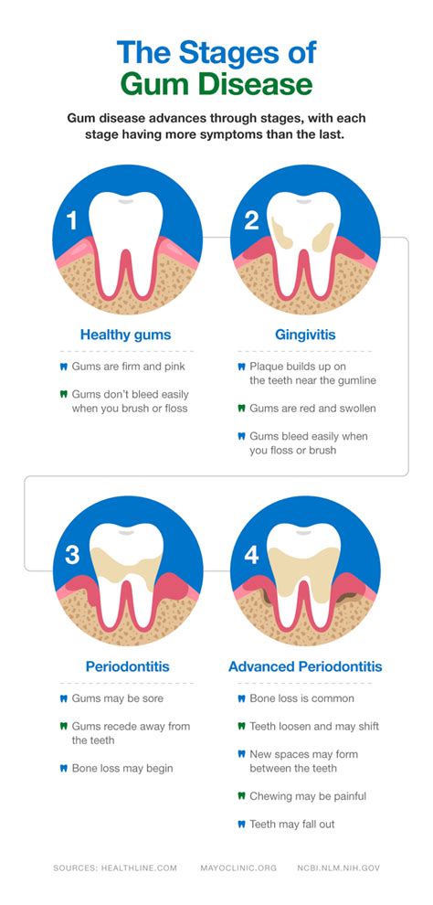 Can amoxicillin treat periodontitis?