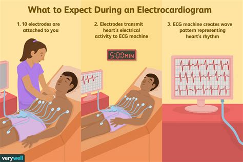 Can an ECG detect anxiety?