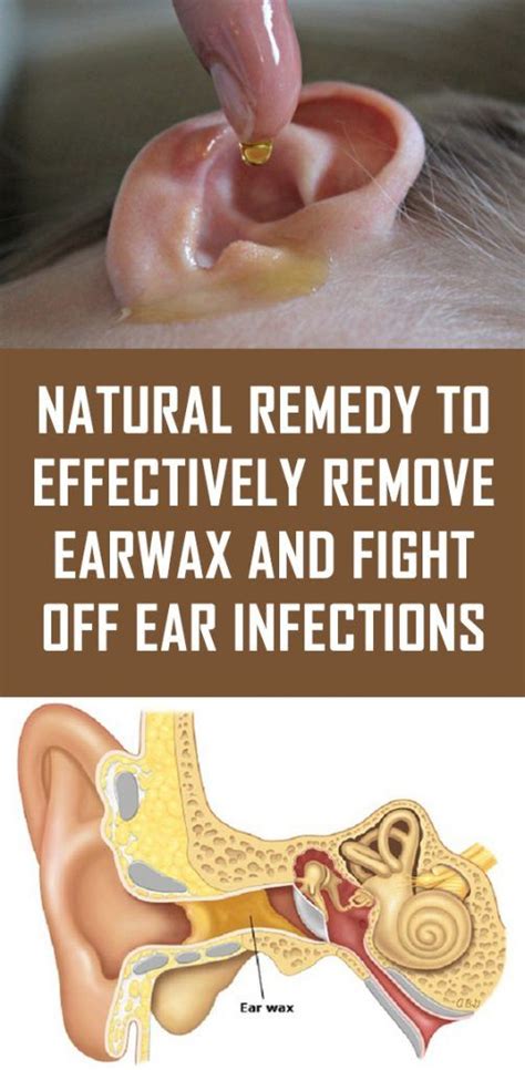 Can an ear infection heal itself?