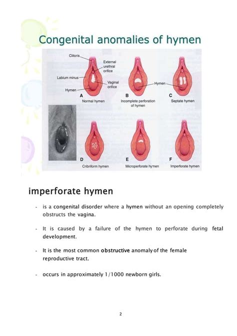 Can an imperforate hymen fix itself?
