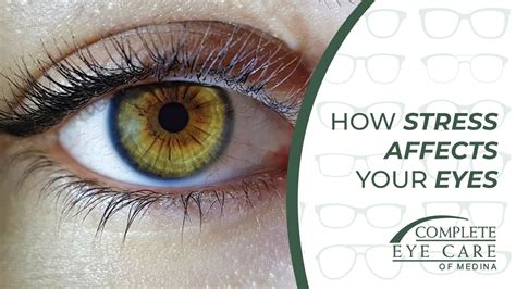 Can anxiety affect your eyes?