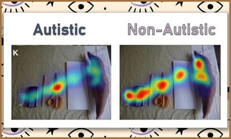 Can autism be seen in eyes?