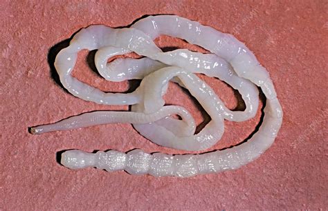 Can babies get tapeworms?