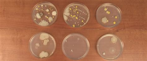 Can bacteria grow in vinegar?