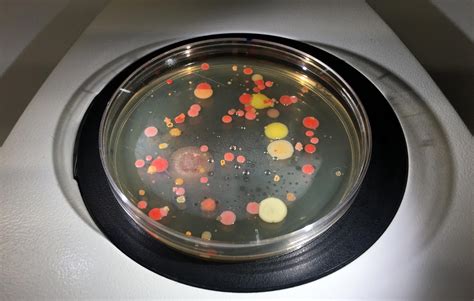 Can bacteria grow on silicone?
