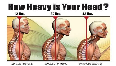 Can bad posture cause neck fat?