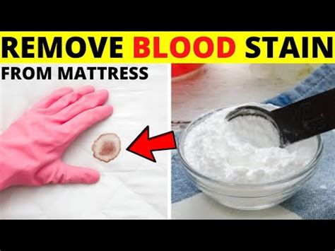 Can baking soda remove blood stains?