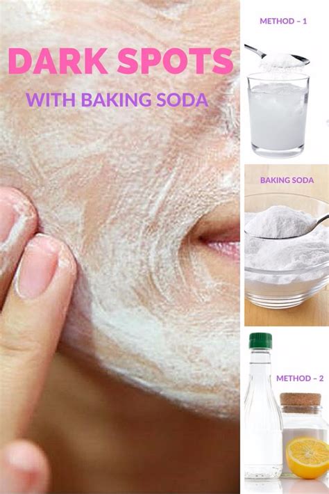Can baking soda remove dark spots?