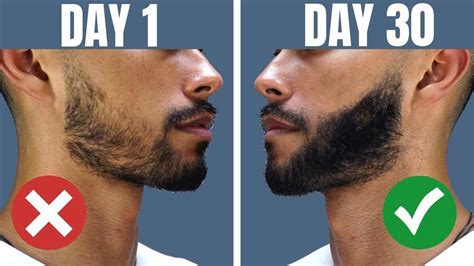 Can beard grow after 35?