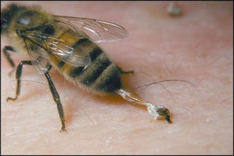 Can bees accidentally sting you?