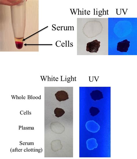 Can blood be detected under UV light?