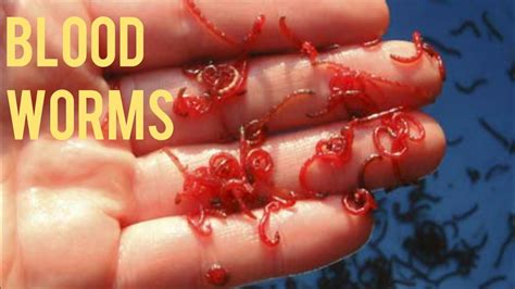 Can bloodworms hurt you?