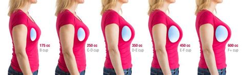 Can breast size increase after 25?