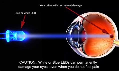 Can bright light permanently damage your eyes?