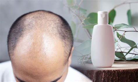 Can caffeine shampoo make hair loss worse?