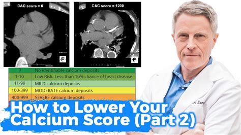 Can calcium scores be wrong?