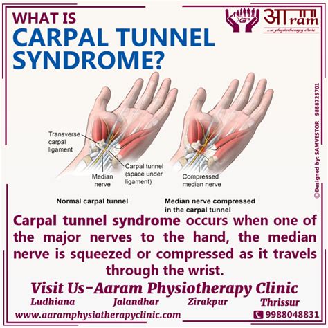 Can carpal tunnel cause permanent?