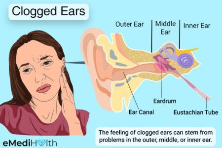 Can catarrh cause blocked ears?