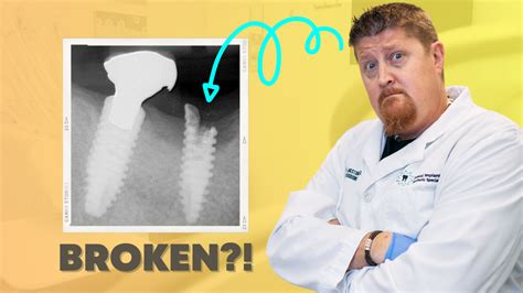 Can ceramic implants break?