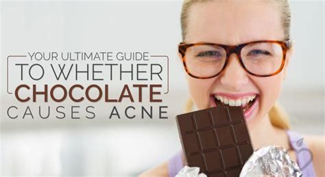 Can chocolate cause acne?
